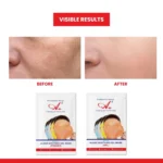 A+ 2010 Oxy Soothing Gel Mask (6 Powder + 6 Gel) - Image 5