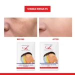 A+ 2030 Vitamin-C Soothing Gel Mask (6 Powder + 6 Gel) - Image 6