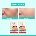 before after result of oxy soothing gel mask