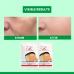 gel face mask remove dullness from your skin