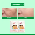 this face mask remove uneven skin tone & dullness