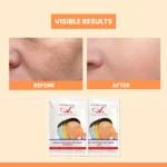 A+ 2030 Vitamin-C Soothing Gel Mask (6 Powder + 6 Gel) - Image 5