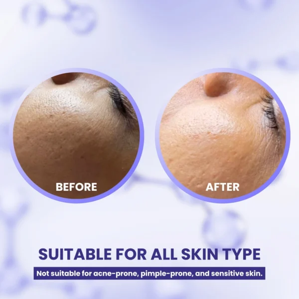 A+ Korean Glass Facial Kit | Used by Professionals | 10x Booster Serums | 7 Steps in 1 Kit | 300 gm + 20 ml